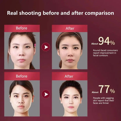 LED Photon Therapy Facial Massager