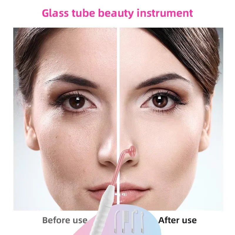 4-in-1 High Frequency Electrode Glass Tube Acne Skin Care Wand