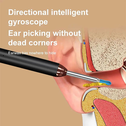 SL01 Visual Ear Cleaner Otoscope